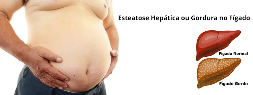 Ilustração médica do fígado destacando a proteção metabólica e filtragem